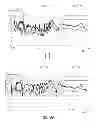 Fig. 08 - ELECTROMAGNETIC INTERFERENCE FILTER AND METHOD OF MANUFACTURING THE SAME