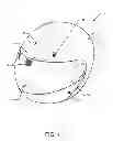 Fig. 02 - METHOD AND APPARATUS FOR DETERMINING THAT MEDICAL ASSISTANCE MAY BE REQUIRED