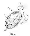 Fig. 04 - Multi-button mouse