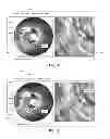 Fig. 10 - Measurement and enhancement in a multi-modality medical imaging system