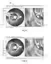 Fig. 11 - Measurement and enhancement in a multi-modality medical imaging system