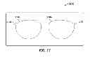 Fig. 09 - Attachable/detachable covering lens