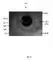 Fig. 05 - Method and algorithm for designing custom optics