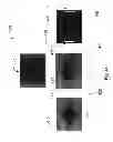 Fig. 06 - Systems and methods for balancing infrared illumination in eye imaging