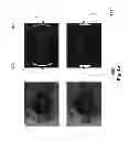 Fig. 07 - Systems and methods for balancing infrared illumination in eye imaging