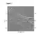 Fig. 07 - METHOD AND DEVICE TO DEGHOST SEISMIC DATA