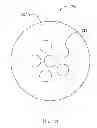 Fig. 06 - Laser