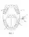 Fig. 02 - Methods and apparatus for transmitting vibrations