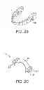 Fig. 04 - Methods and apparatus for transmitting vibrations