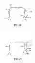 Fig. 16 - Methods and apparatus for transmitting vibrations