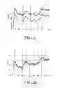Fig. 12 - Apparatus and a method for controlling a sound field