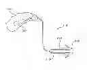 Fig. 01 - RIC assembly with thuras tube