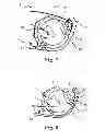 Fig. 05 - Battery door and hearing device