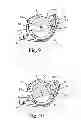 Fig. 06 - Battery door and hearing device