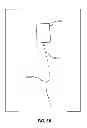 Fig. 04 - Faulty cart wheel detection