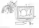 Fig. 01 - Method for recording multiple three-dimensional images of a dental object
