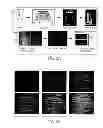 Fig. 05 - Methods and apparati for nondestructive detection of undissolved particles in a fluid