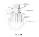 Fig. 12 - Methods and apparati for nondestructive detection of undissolved particles in a fluid