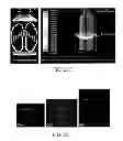 Fig. 37 - Methods and apparati for nondestructive detection of undissolved particles in a fluid