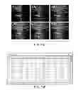 Fig. 40 - Methods and apparati for nondestructive detection of undissolved particles in a fluid