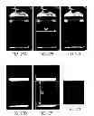 Fig. 41 - Methods and apparati for nondestructive detection of undissolved particles in a fluid