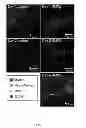 Fig. 10 - METHODS FOR IMAGING BONE PRECURSOR CELLS USING DUAL-LABELED IMAGING AGENTS TO DETECT MMP-9 POSITIVE CELLS