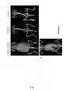 Fig. 12 - METHODS FOR IMAGING BONE PRECURSOR CELLS USING DUAL-LABELED IMAGING AGENTS TO DETECT MMP-9 POSITIVE CELLS