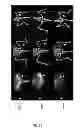 Fig. 13 - METHODS FOR IMAGING BONE PRECURSOR CELLS USING DUAL-LABELED IMAGING AGENTS TO DETECT MMP-9 POSITIVE CELLS