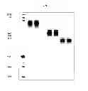 Fig. 04 - Ultrafiltration concentration of allotype selected antibodies for small-volume administration