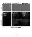 Fig. 07 - Methods and compositions for detection of cancer