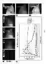 Fig. 09 - Methods and compositions for detection of cancer