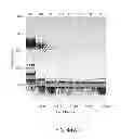 Fig. 72 - Methods using DNA methylation for identifying a cell or a mixture of cells for prognosis and  diagnosis of diseases, and for cell remediation therapies