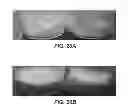 Fig. 30 - Stabilized liquid and lyophilized ADAMTS13 formulations