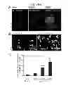 Fig. 03 - Methods of Treating Inflammatory Diseases by Targeting the Chemoattractant Cytokine Receptor 2 (CCR2) or Chemokine (C-C motif) Ligand 2 (CCL2)