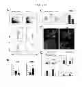 Fig. 09 - Methods of Treating Inflammatory Diseases by Targeting the Chemoattractant Cytokine Receptor 2 (CCR2) or Chemokine (C-C motif) Ligand 2 (CCL2)