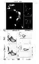 Fig. 10 - Methods of Treating Inflammatory Diseases by Targeting the Chemoattractant Cytokine Receptor 2 (CCR2) or Chemokine (C-C motif) Ligand 2 (CCL2)