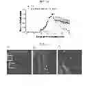 Fig. 14 - Methods of Treating Inflammatory Diseases by Targeting the Chemoattractant Cytokine Receptor 2 (CCR2) or Chemokine (C-C motif) Ligand 2 (CCL2)