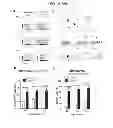 Fig. 30 - Methods of Treating Inflammatory Diseases by Targeting the Chemoattractant Cytokine Receptor 2 (CCR2) or Chemokine (C-C motif) Ligand 2 (CCL2)