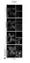 Fig. 31 - Methods of Treating Inflammatory Diseases by Targeting the Chemoattractant Cytokine Receptor 2 (CCR2) or Chemokine (C-C motif) Ligand 2 (CCL2)