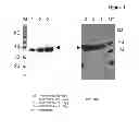 Fig. 02 - Amino acid sequence presenting fusion polypeptide and its use