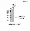 Fig. 16 - Amino acid sequence presenting fusion polypeptide and its use