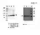 Fig. 33 - Amino acid sequence presenting fusion polypeptide and its use