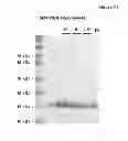 Fig. 37 - Amino acid sequence presenting fusion polypeptide and its use