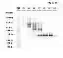 Fig. 40 - Amino acid sequence presenting fusion polypeptide and its use