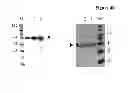 Fig. 43 - Amino acid sequence presenting fusion polypeptide and its use