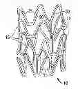 Fig. 01 - Anti-proliferative and anti-inflammatory agent combination for treatment of vascular disorders with an implantable medical device