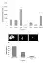 Fig. 04 - COMPOUNDS AND COMPOSITIONS FOR USE IN THE TREATMENT AND PREVENTION OF LUNG AND BRAIN CANCER AND PRECANCEROUS CONDITIONS THEREOF