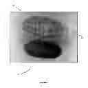 Fig. 07 - Mummified mealy bug product and method