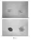 Fig. 02 - Methods of treating gastrointestinal spasms in a subject having diverticulitis