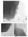 Fig. 08 - High capacity cathode material with stabilizing nanocoatings